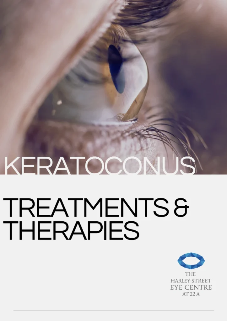 Keratoconus Management Brochure